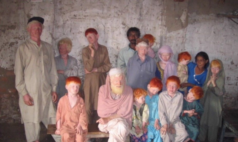                   Albinos dravidiens (sud de l'Inde)