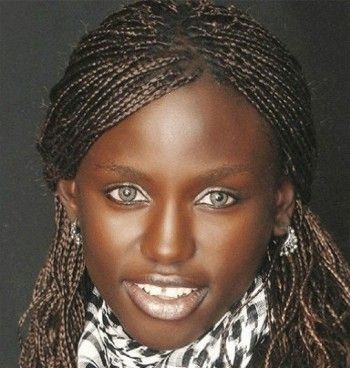     Albinisme partiel chez les noirs: yeux clairs