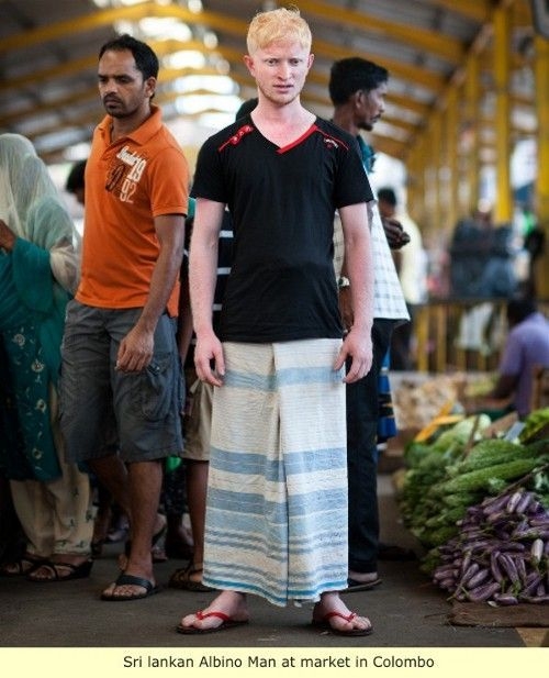 Homme albinos (sud de l'Inde) ressemble aux blancs