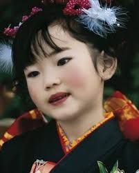 Albinisme  chez les jaunes :peau blanche cheveux et yeux noirs